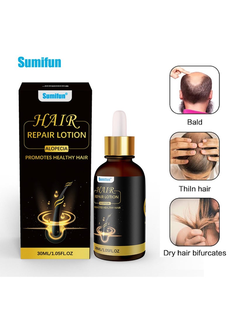 Sumifun - Hair Repair Lotion, Hair Oil, Hair Loss Treatment, Moisturizing Anti Loss Hair Growth Essence, Promote Healthy Hair, Strengthen Hair Growth 30ml - Image 1