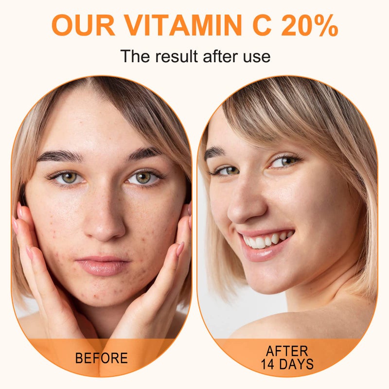 ELBBUB Premium 20% Vitamin C Serum For Face with Hyaluronic Acid, Retinol & Amino Acids - Boost Skin Collagen,Hydrate & Plump Skin, Anti Aging & Wrinkle Facial Serum 60ml - Image 5