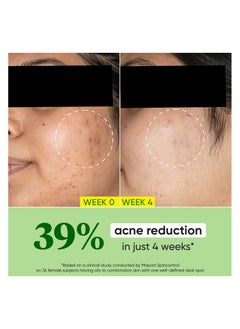 Dot & Key Dot & Key CICA Claming Skin Renewing Night Gel | Night Cream with Niacinamide, Green Tea & Hyaluronic | Reduces Acne, Dark Spots & Pigmentation, For Oily, Acne Prone And Sensitive Skin | 60ml  - Image 4
