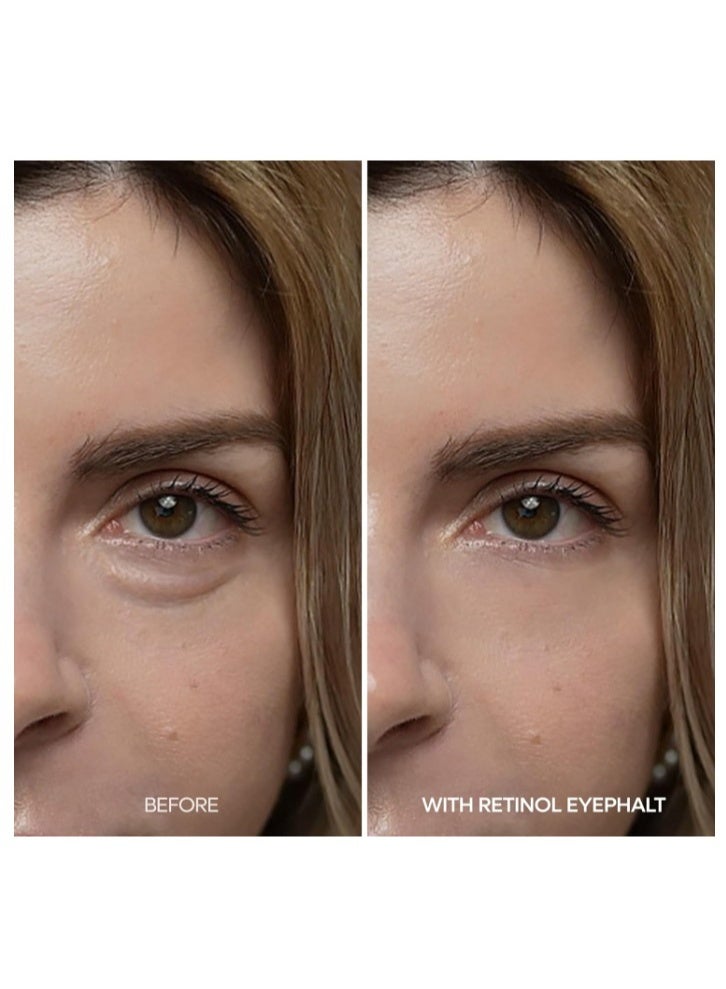 Dr. Eyephalt Retinol Eye Bag Cream 10g – Anti-Aging Under Eye Treatment for Puffiness, Dark Circles & Fine Lines - Image 4