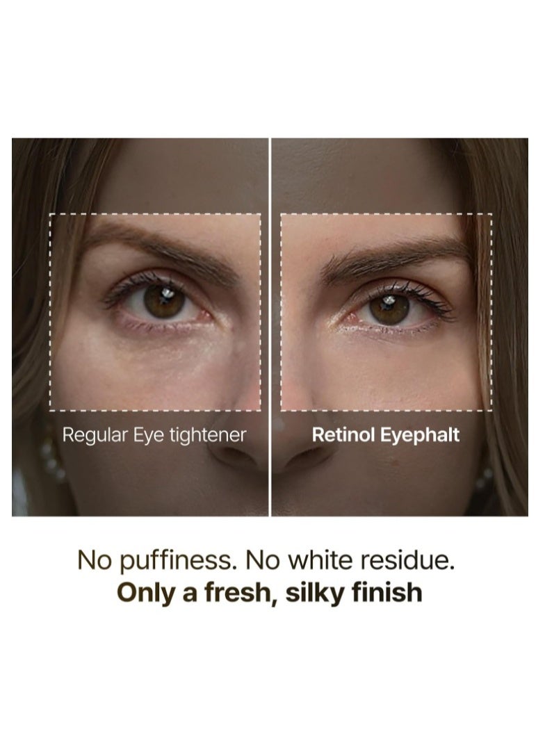 Dr. Eyephalt Retinol Eye Bag Cream 10g – Anti-Aging Under Eye Treatment for Puffiness, Dark Circles & Fine Lines - Image 3