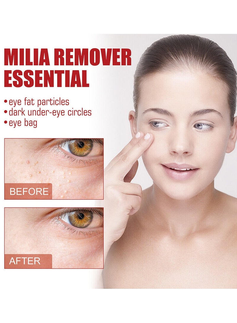 SOUTH MOON Fat Removing Granule Essence, Fade Fine Lines, Remove Eye Surrounding Granules, Lift And Tighten Eyes Essence,30ml  - Image 2