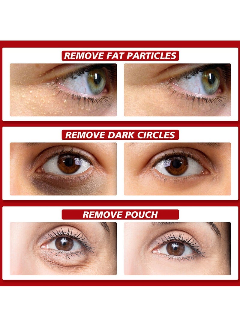 SOUTH MOON Fat Removing Granule Essence, Fade Fine Lines, Remove Eye Surrounding Granules, Lift And Tighten Eyes Essence,30ml  - Image 5