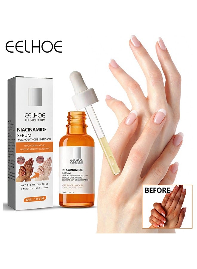 EELHOE Niacinamide Serum- Reduce Dark Patches Restoring Hand Treatment, Moisturizing, Exfoliates and Reduces Unbalanced Pigmentation, for Removing Dark Elbow and Knee , Brighter Firmer Skin - Image 1