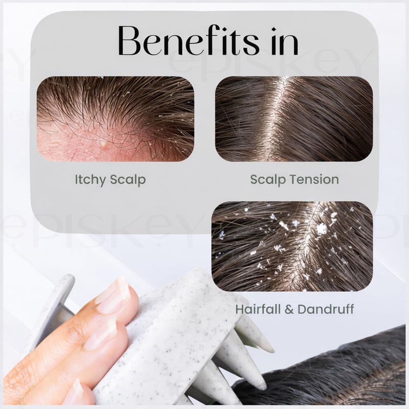 Episkey Scalp Massager Shampoo Brush for Hair Wash Anti-Dandruff Silicone Scalp Scrubber with Soft Bristles | Deep Clean, Exfoliation & Hair Growth Ayurvedic Head Massage Brush for Men&Women(JW-35) - Image 3