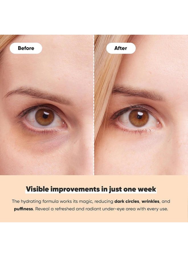 Le Gushe - Under Eye Patches - Gold Under Eye Masks for Dark Circles and Puffiness - With Collagen & Amino Acids - Gifts for Women - Bridesmaid Gifts (20 pairs) - Image 1