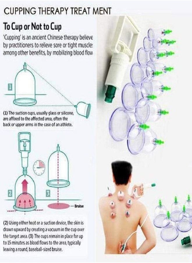 A set of Islamic cupping cups with a suction device 12 pieces is the ideal way for natural treatment and purification - pzsku/Z574879C952CA22B77719Z/45/_/1724741050/e2796e34-a765-4135-8e14-be8c95992a0e