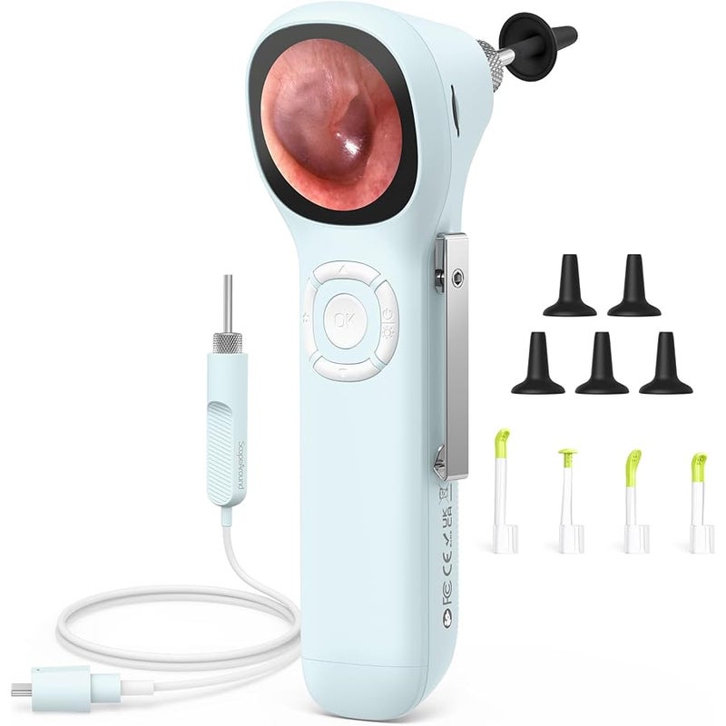 ScopeAround Digital Otoscope w/IPS Screen, 720p HD Smart Video Otoscope with Light, Ear Scope Otoscope with Camera Ear Wax Removal Camera, Ear Checker, Power On and Go (Blue) - Image 1