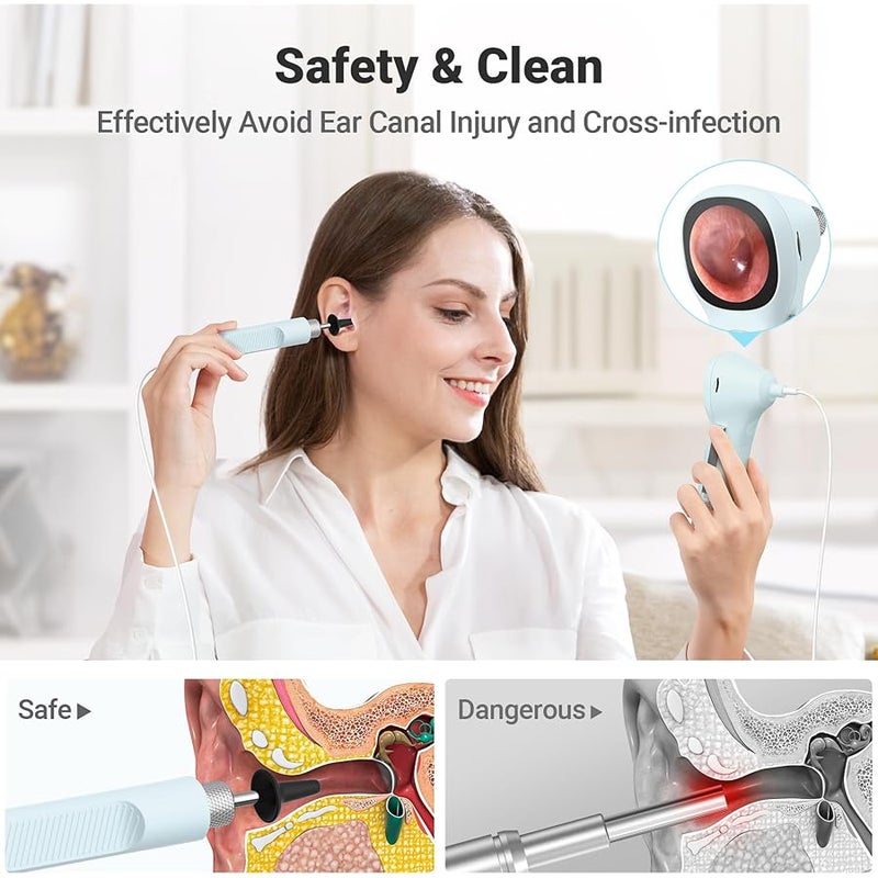 ScopeAround Digital Otoscope w/IPS Screen, 720p HD Smart Video Otoscope with Light, Ear Scope Otoscope with Camera Ear Wax Removal Camera, Ear Checker, Power On and Go (Blue) - Image 5