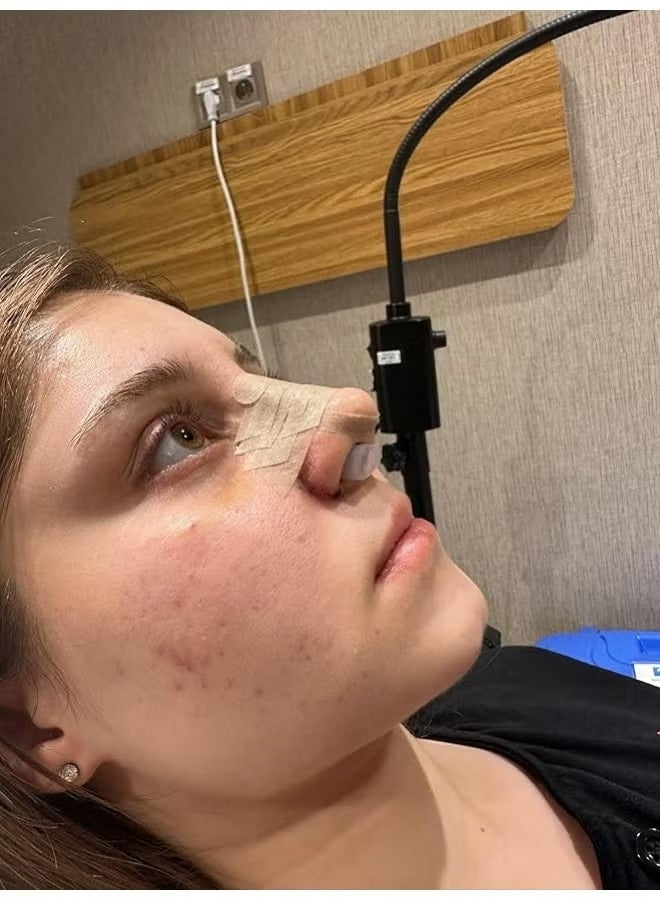 مثبت أنف سيليكون صحي الوجه وشريط جراحي بالمسام الدقيقة سعة 1.25 سم، وسادة الأنف للجراحة، مثبت الأنف، مثبت الأنف لجراحة العمل، %100 مسمار أنف أنف السيليكون (رقم 8) - Image 3