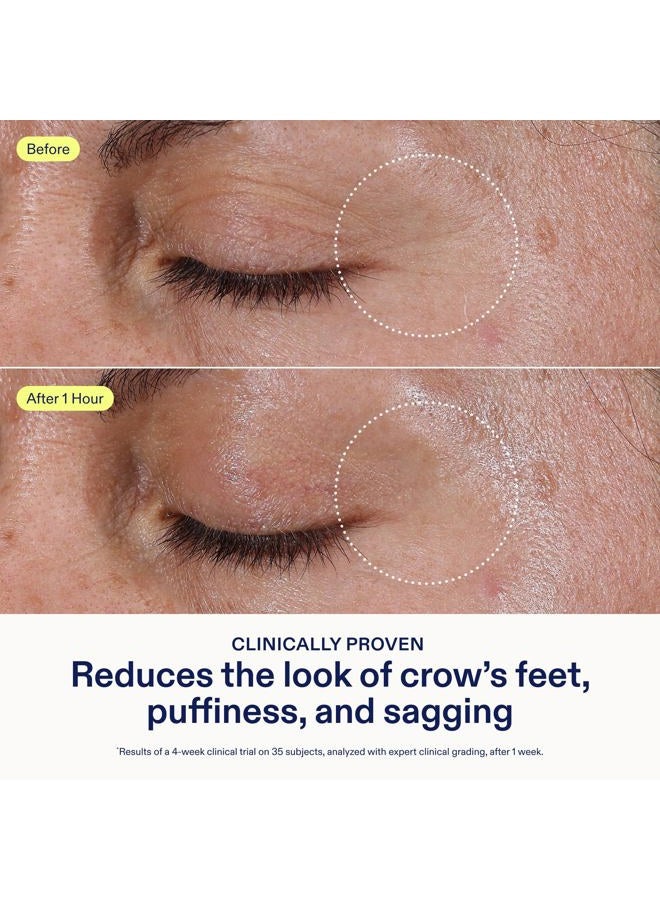Skinfix Triple Lipid Eye Treatment - 0.5 fl oz - Eye Cream - Visibly Tightens, Depuffs & Smooths Undereyes - Non-Comedogenic - Fragrance Free - Vegan, Cruelty Free - Image 3