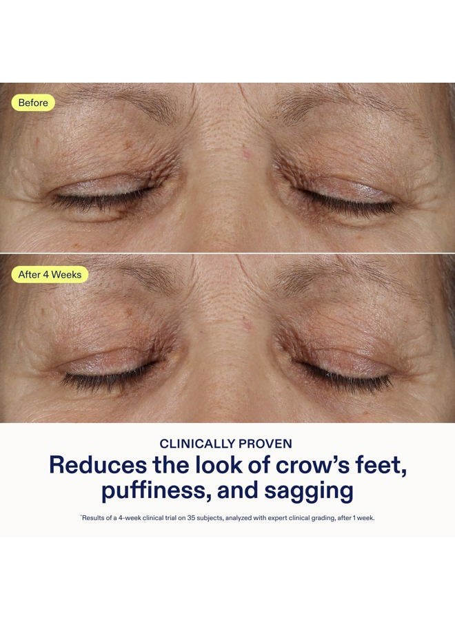 Skinfix Triple Lipid Eye Treatment - 0.5 fl oz - Eye Cream - Visibly Tightens, Depuffs & Smooths Undereyes - Non-Comedogenic - Fragrance Free - Vegan, Cruelty Free - Image 4