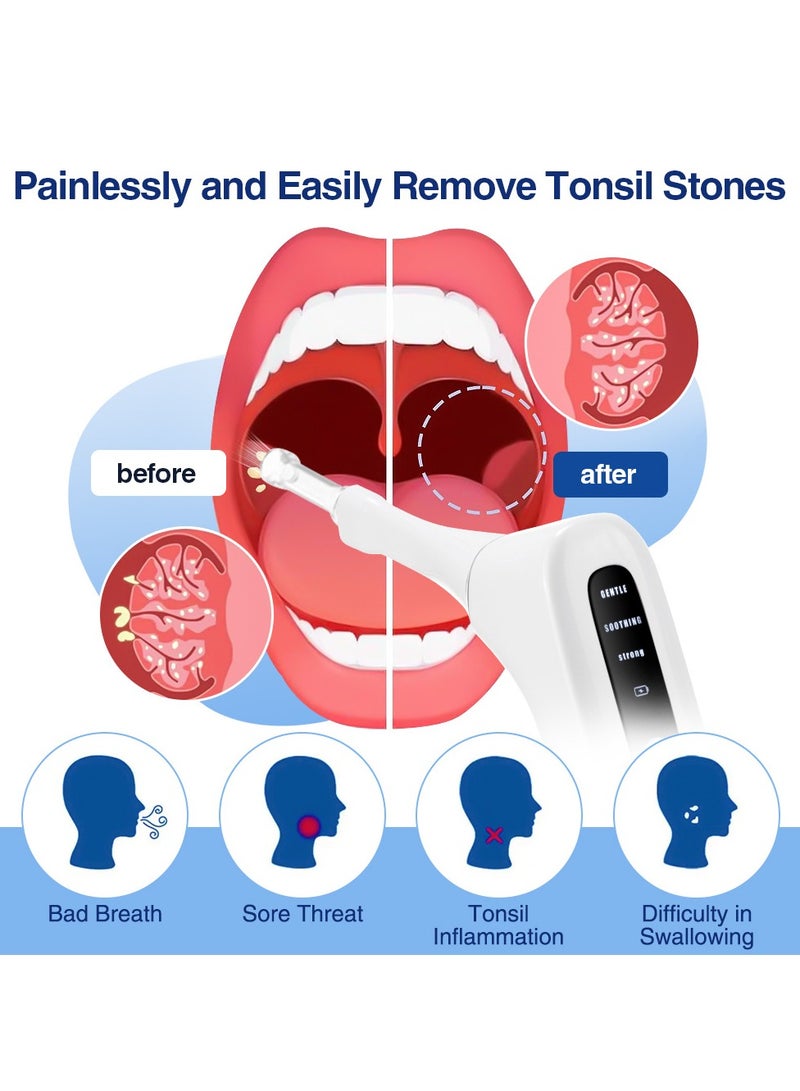 Home Portable Tonsil Stone Remover - Electric Suction Oral Care Tool with 3 Suction Modes  4 Silicone Tips, for Bad Breath  Throat Discomfort Relief - Image 4