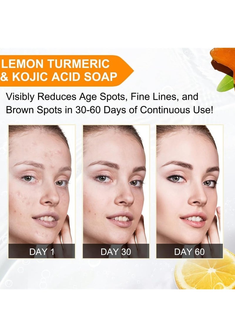 IKZEE - Lemon Turmeric Kojic Acid Soap - Dark Spot Corrector, Deep Cleansing Bar - Brightening & Moisturizing Soap for Face & Body - Natural Skin Whitening Formula (100g) - Image 1