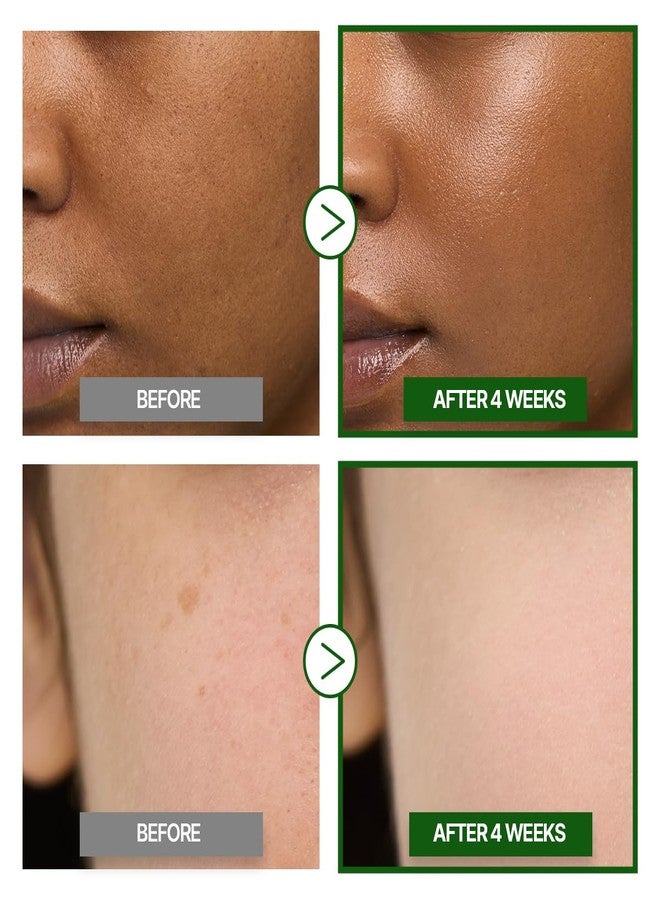 GOODAL Green Tangerine Vitamin C Cream [Advanced Ver.] – Vitamin C Cream with 5% Niacinamide | Fades Dark Spots, Boosts Radiance & Hydrates | Korean Skincare 1.69oz / 50ml - Image 5