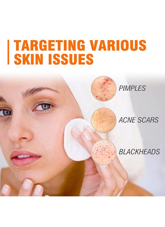 West&Month Acne Face Cream 100g, Acne Spot Treatment for Face & Acne Dots, Natural Cystic Acne Treatment, For All Skin Types, Premium Acne Scar Cream & Pimple Remover 100g  - Image 5