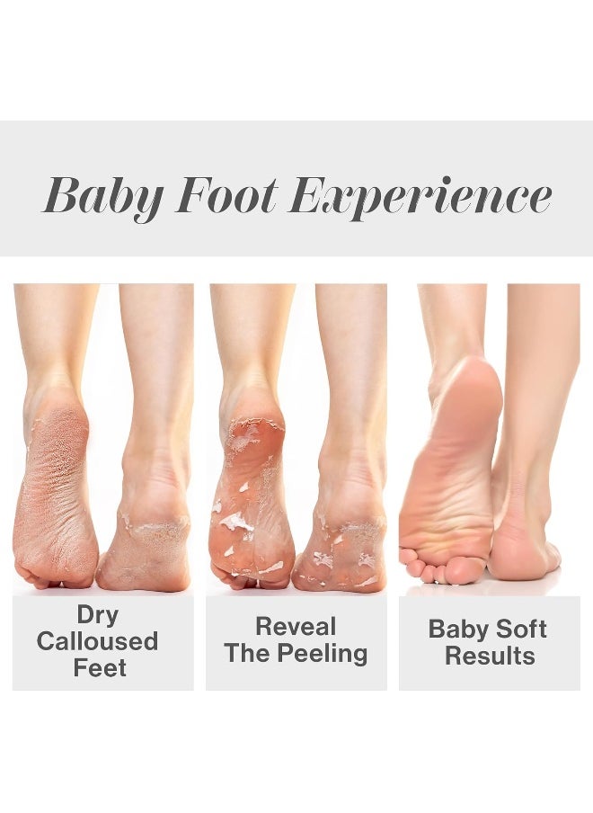Baby Foot - - Original Exfoliant Foot Peel - 2.4 Fl. Oz. Lavender Scented Pair - Image 1
