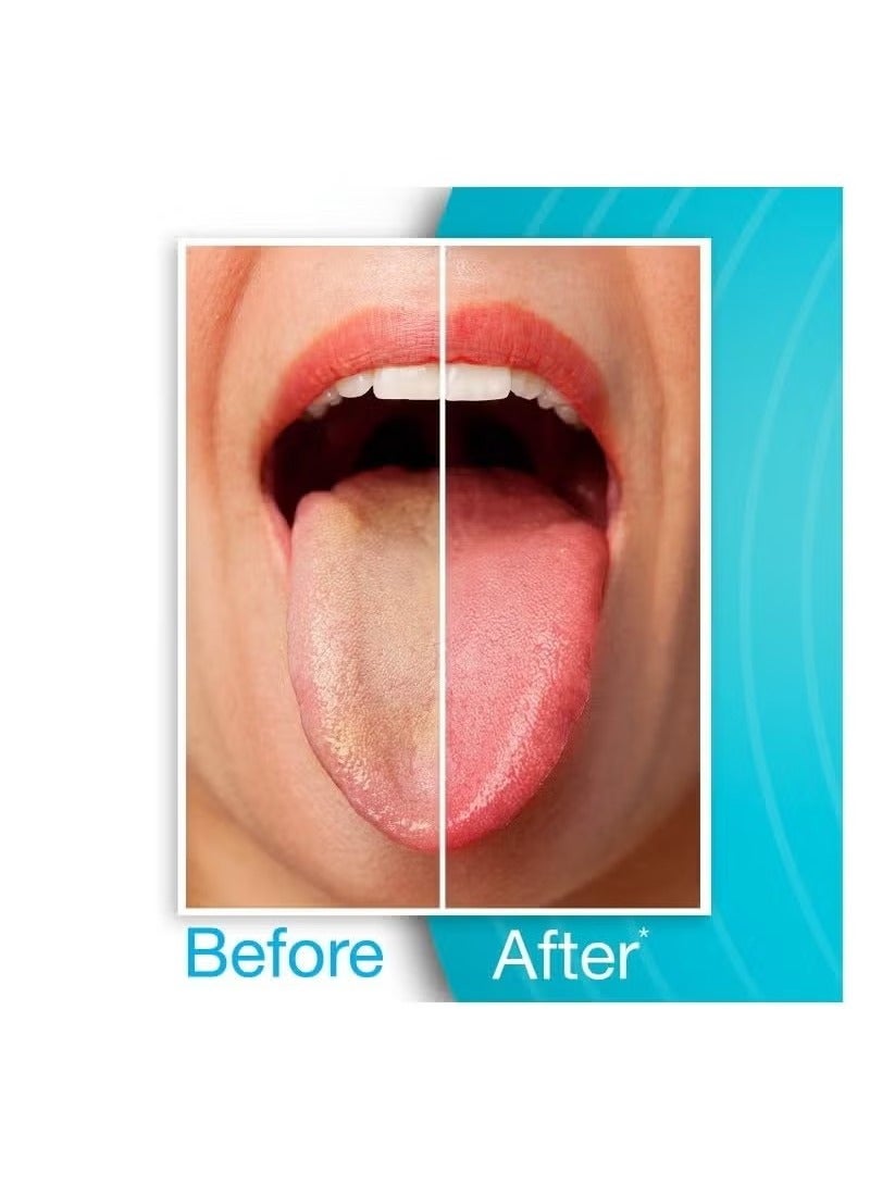 اترجسز 3 قطعة اللسان مكشطة ، الفولاذ المقاوم للصدأ لتنظيف الفم ، والحد من رائحة الفم الكريهة - Image 3