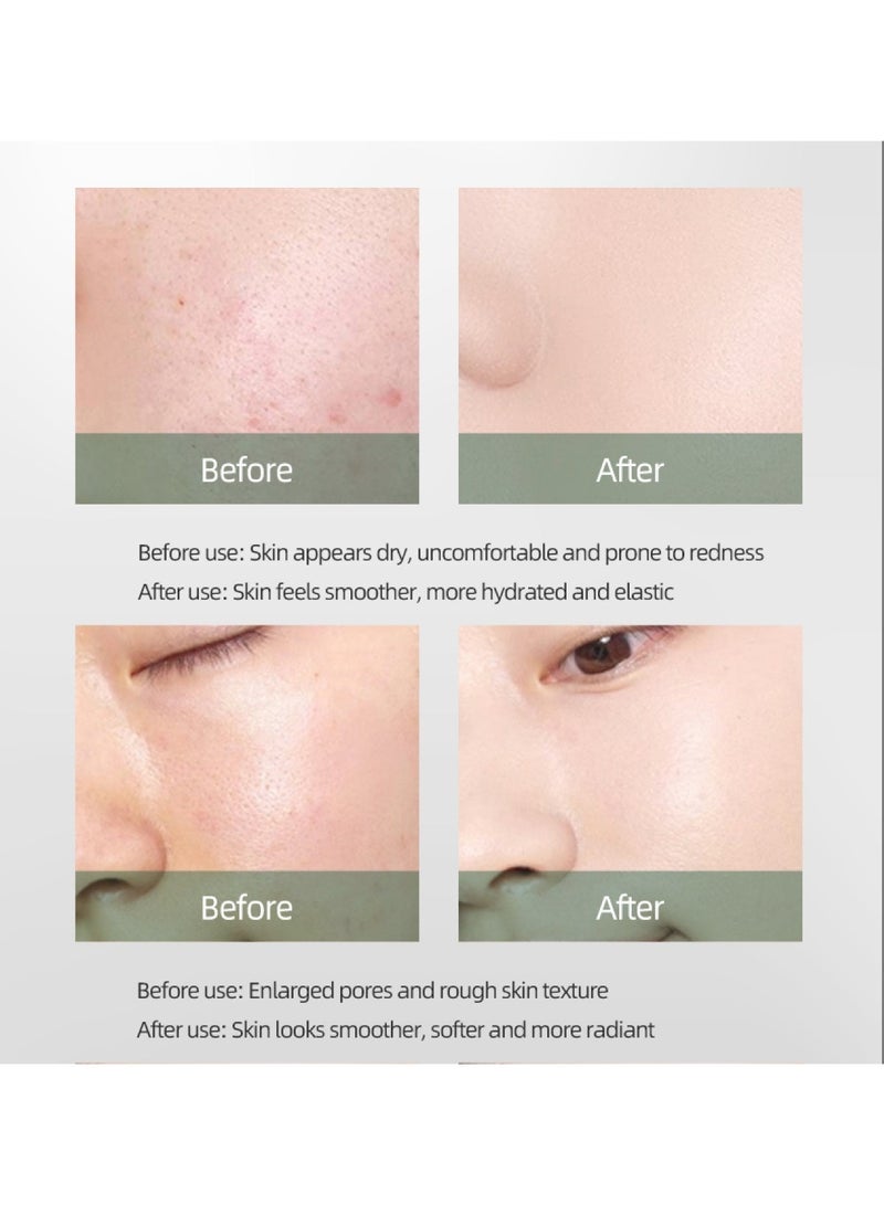 VNM Anti-Aging & Hydrating Peptide Face Sheet Mask - Instant Soothing & Repair with Hyaluronic Acid, Aloe Vera, Panthenol & Ectoin, 1pc - Image 3