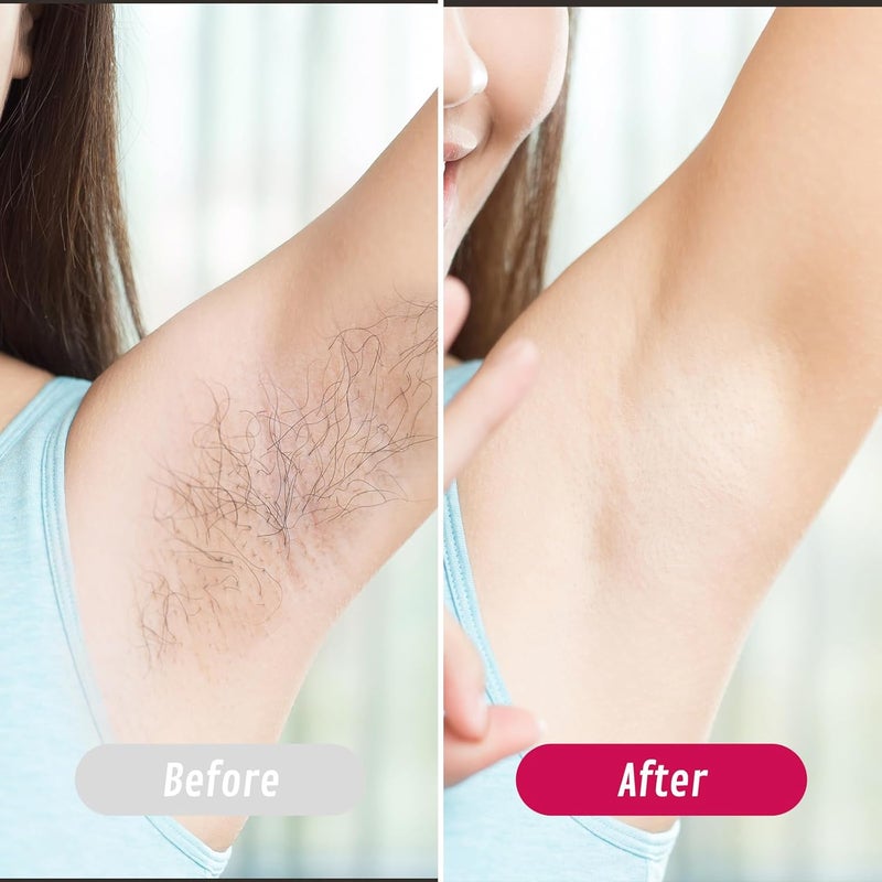 Charmonic Roll On Wax Kit, Portable Wax Roller Kit for Coarse/Fine Hair Removal, Beginners Waxing Roller for All Skin Types with 3 Pcs 100g Roll Cartridge, 100 Non-Woven Strips & 10 After Oil Wipes (F1_White) Market demand focused build - Image 3