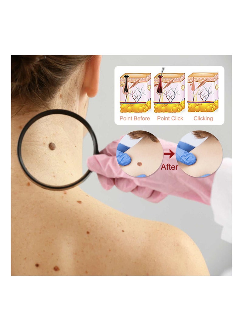 EELHOE Natural Skin Mole Remover Liquid - Image 2