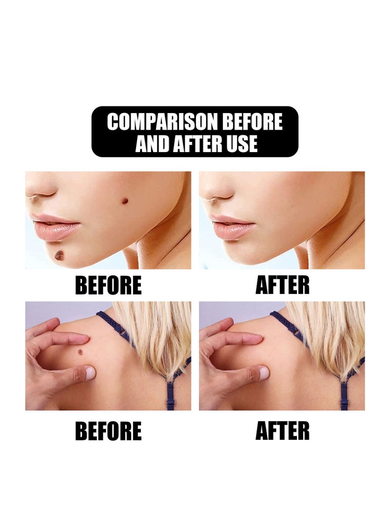 EELHOE Natural Skin Mole Remover Liquid - Image 4