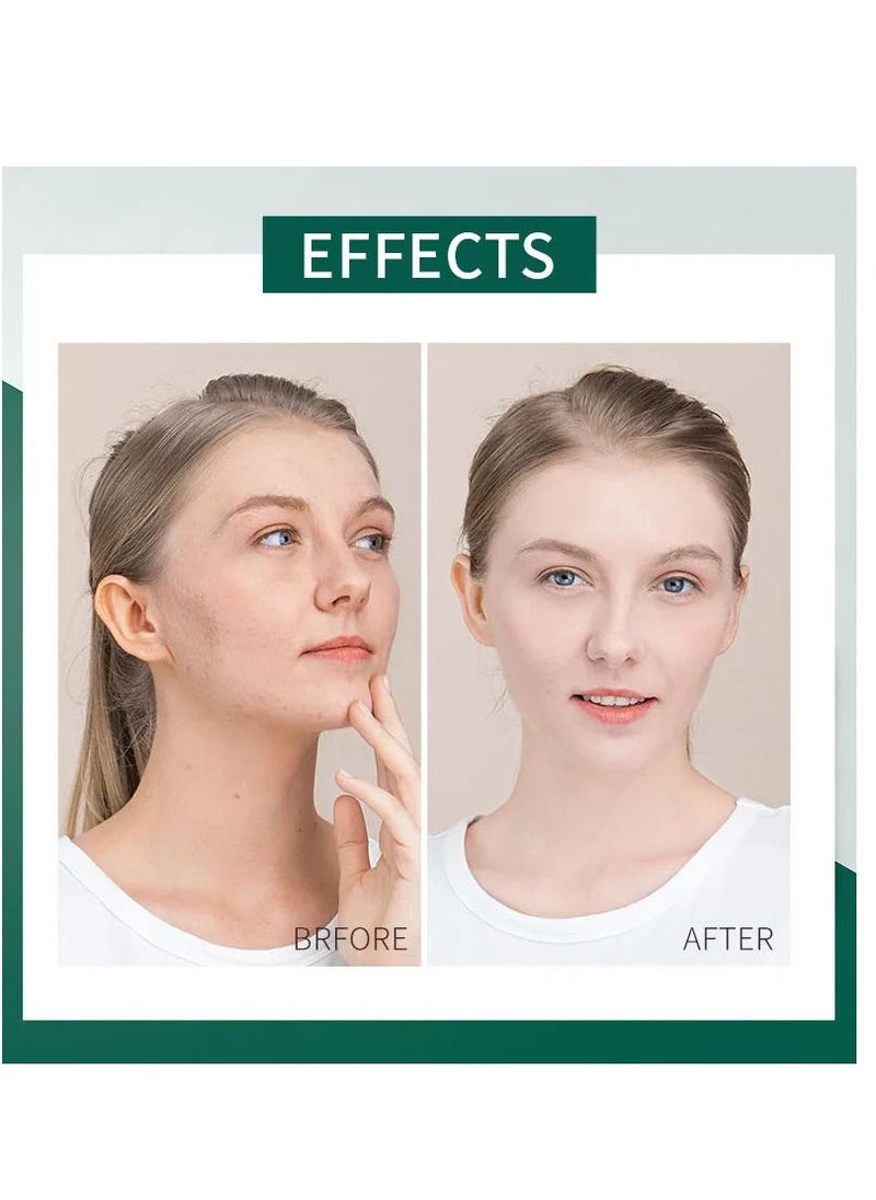 Centella - Centella Frozen Moisturizing Anti-Wrinkle Soothing After Sun Sleeping Mask 12pcs - Image 1