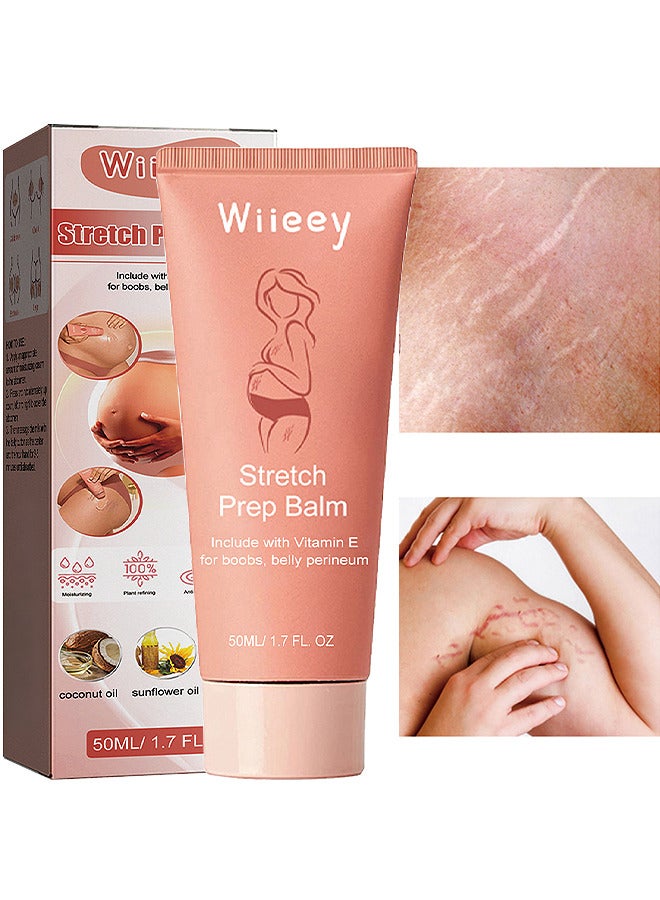 wiieey Stretch Prep Balm, Stretch Marks Remover Essential Care Cream, 100% Natural Pure Plant Extract, Improve The Appearance Of Scars, Stretch Marks And Skin Tone, Remove Marks, 50ML - Image 1