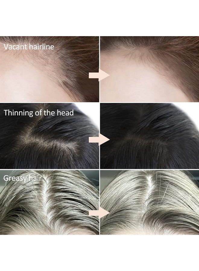 Boobeen Hair Powder for Thin Hair, Root Touch Up Powder Hair Shadow Cover Hair Loss Instantly, Hairline Powder for Women Men - Image 2