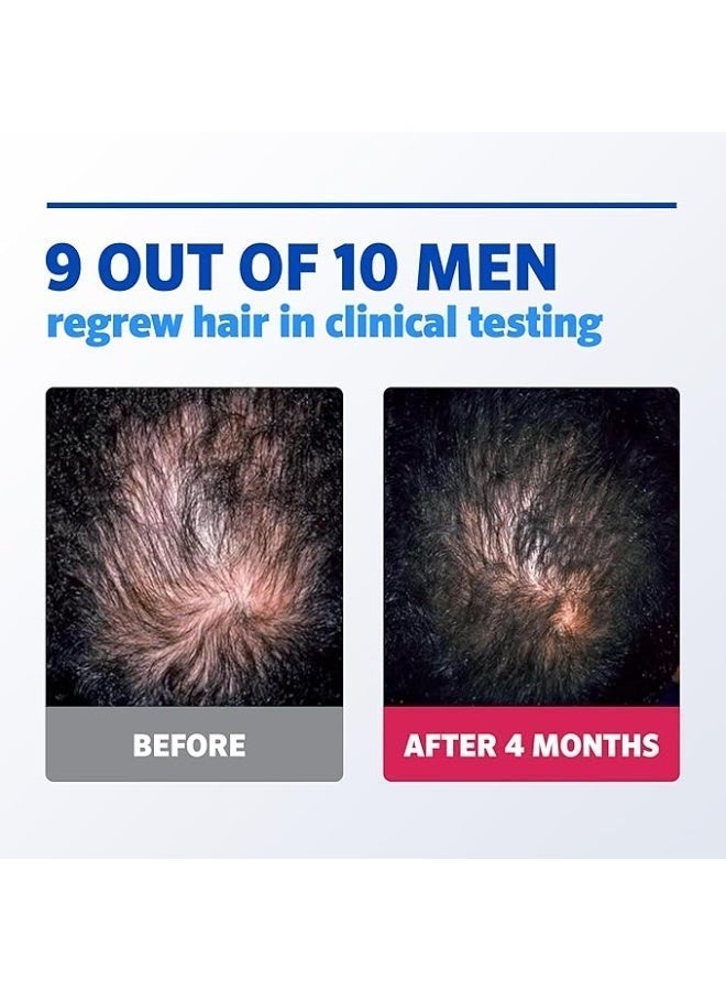 روجين Men's Rogaine 5% Minoxidil Foam for Hair Loss and Hair Regrowth, Topical Treatment for Thinning Hair, 3-Month Supply 2.11 Ounce, 3 Countounce 60ggrams - Image 2