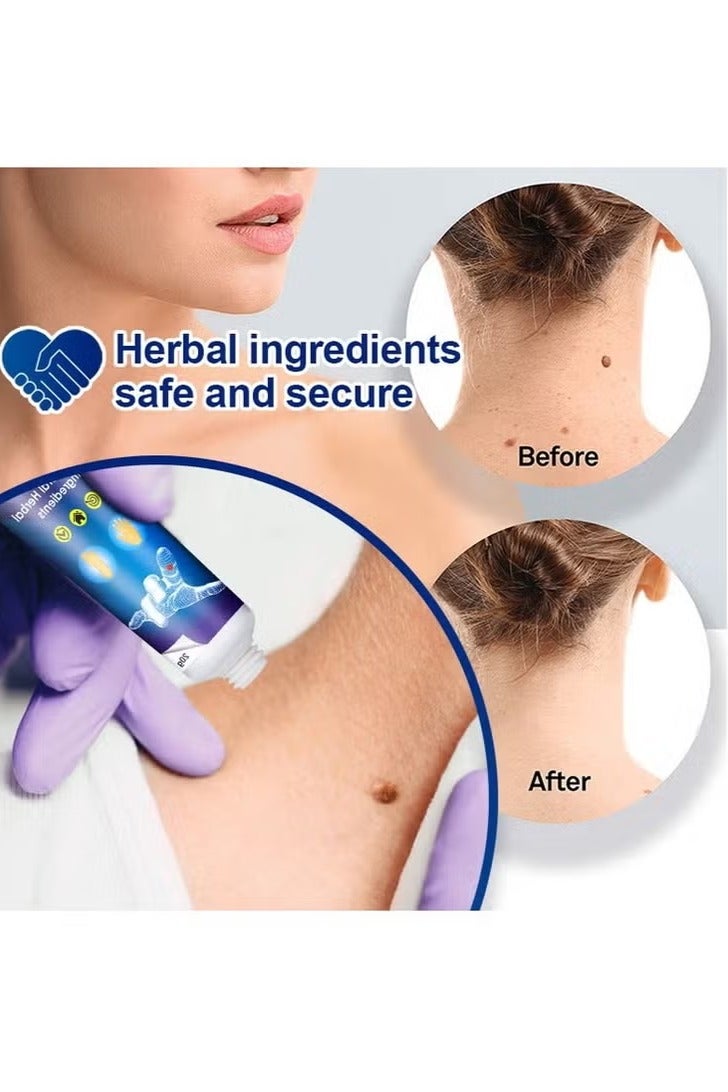 Sumifun مرهم إزالة الثآليل، ميستاحا 20 جرام - مكونات طبيعية لعلاج الثآليل بأمان، حب الشباب، الشامات، وتقليل الندبات - Image 3