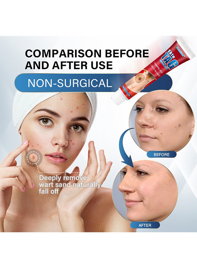 Sumifun Skin Tag Removal Cream, Remove Warts, Remove Moles And Smooth Skin, Skin Tag For Common Treatment Effective And Safe 20G - Image 4