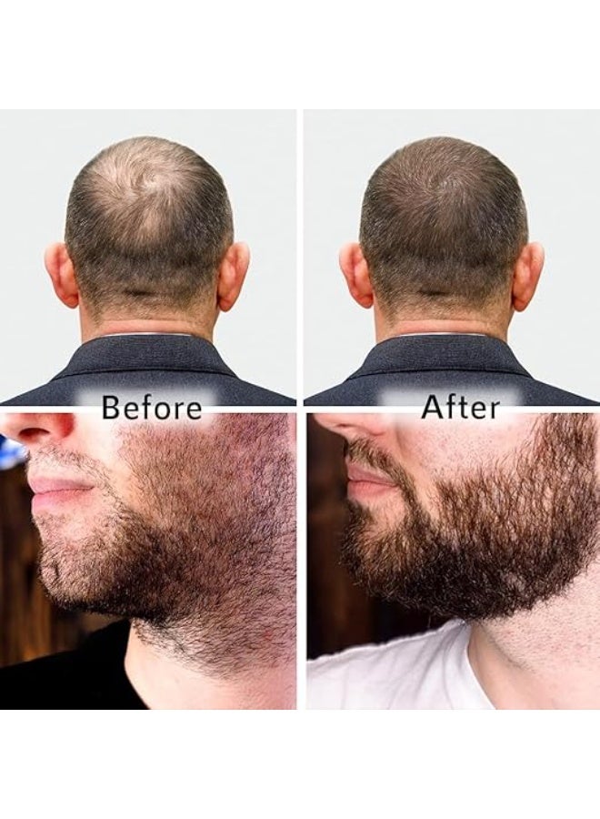ORGATRE Hair Growth Serum 2.0-30ml | For Beard & Scalp | Reduces Hairfall & Thinning | 1.5% Aminexil, Redensyl, Anagain & Procapil | Hair Growth Serum for Men - Image 3