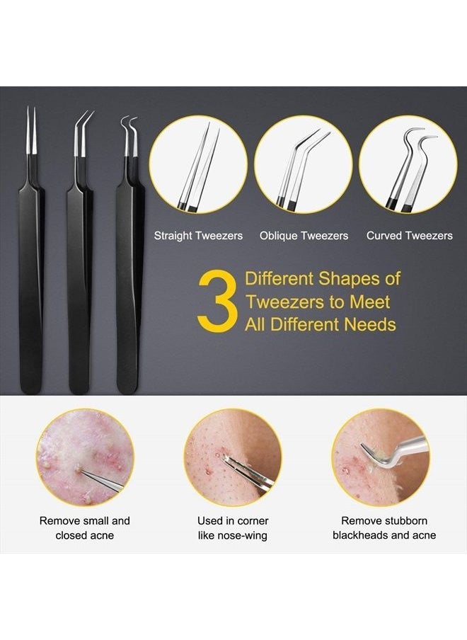 Pimple Popper Tool Kit - Boxoyx 10 Pcs Blackhead Remover Comedone Extractor Kit with Metal Case for Quick and Easy Removal of Pimples, Blackheads, Zit Removing, Forehead,Facial and Nose（Black)