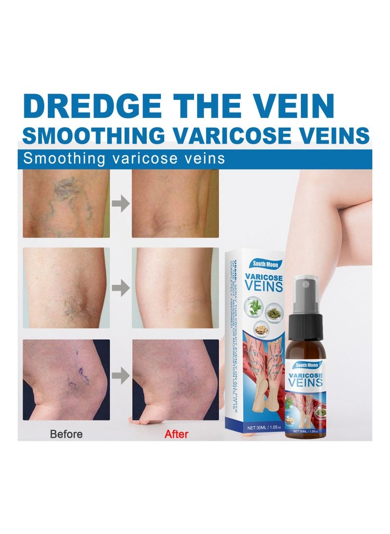 SOUTH MOON Veinhealing Varicose Veins Treatment Spray  - Image 4