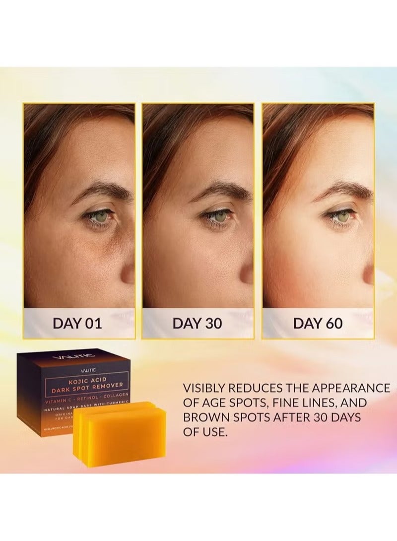 فاليتيك صابون حمض الكوجيك لإزالة البقع الداكنة و تفتيح البشرة (عبوتين) - مع فيتامين سي، الريتينول، الكولاجين، الكركم | مركب ياباني مع حمض الهيالورونيك، فيتامين إي، زبدة الشيا، زيت الزيتون - Image 2