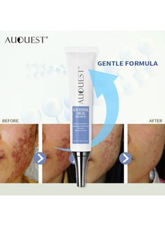 AuQuest Acne Remoyal Gure Gel -Herbal Acne Treatment Cream Pimple Spot Removal for Teens Oil Control Acne Scar Gel Shrink Pores Skin Care Beauty Health 20g  - Image 4