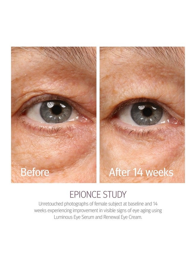 إبيونس كريم إبيونس رينيوال للعين - مضاد للشيخوخة، الهالات السوداء والانتفاخات، حمض الهيالورونيك، مُفتِّح لمنطقة تحت العين - Image 3