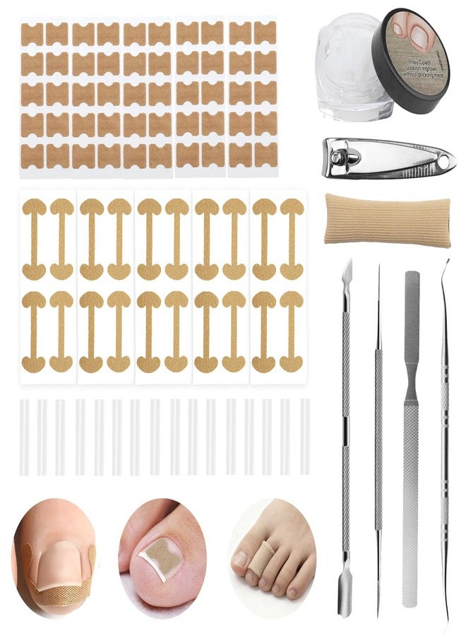 SEILETOO Ingrown Toenail Corrector Set with Breathable Correction Strips, Upgraded Ingrown Toenail Treatment Kit, Curved Toenails Corrector Patch, Pedicure Tools, for Home Use Women Man - Image 1