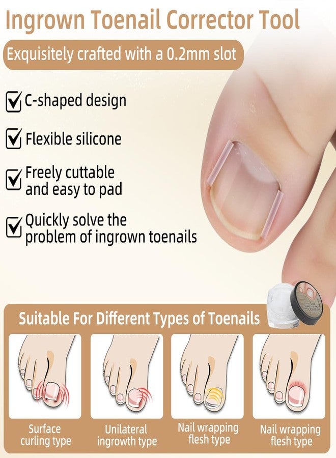 SEILETOO Ingrown Toenail Corrector Set with Breathable Correction Strips, Upgraded Ingrown Toenail Treatment Kit, Curved Toenails Corrector Patch, Pedicure Tools, for Home Use Women Man - Image 4