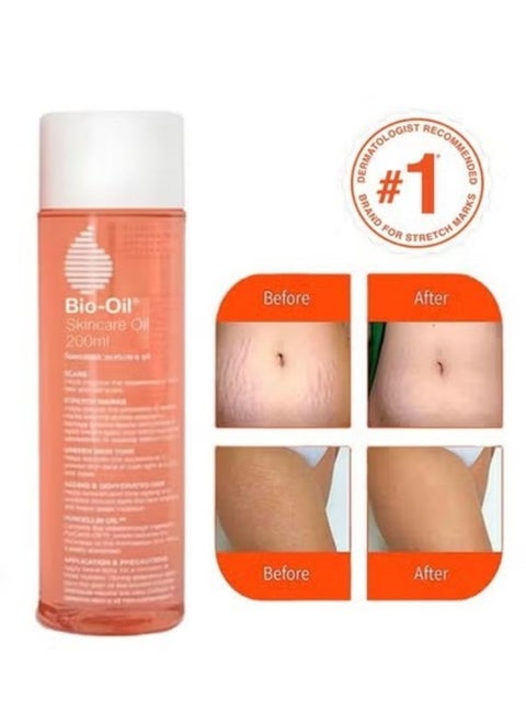 Skincare Body Oil 200mL, Vitamin E Serum for Scars and Stretchmarks, Suitable for All Skin Types, Helps Improve the Appearance of Both New or Old Scars, Uneven Skin Tone In Both Light and Dark Skin