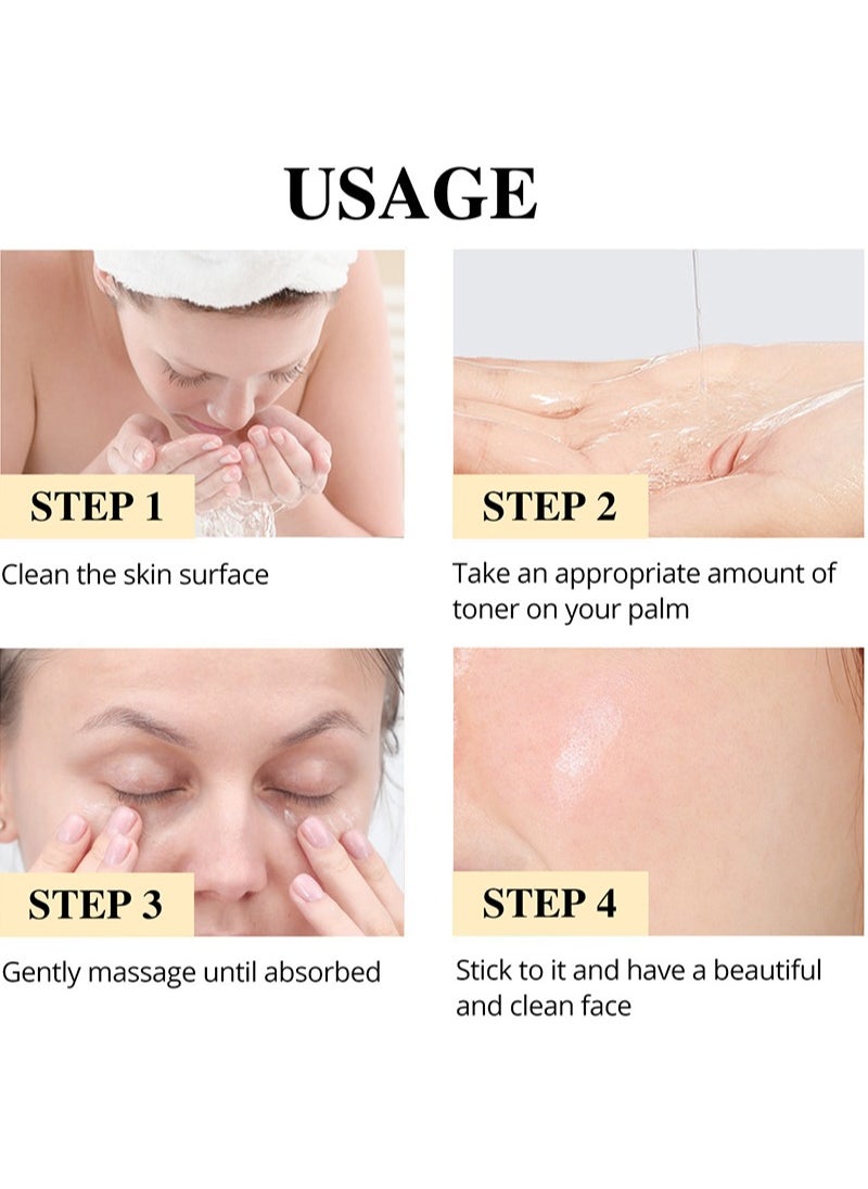 SAUVASINE - Turmeric Facial Toner for Dark Spots,Facial Toner for Acne Prone Skin, Facial Dark Spot Remover Facial Moisturizer for Women, Moisturizing Facial Toner for Dry Oily Skin - 100ml - Image 1