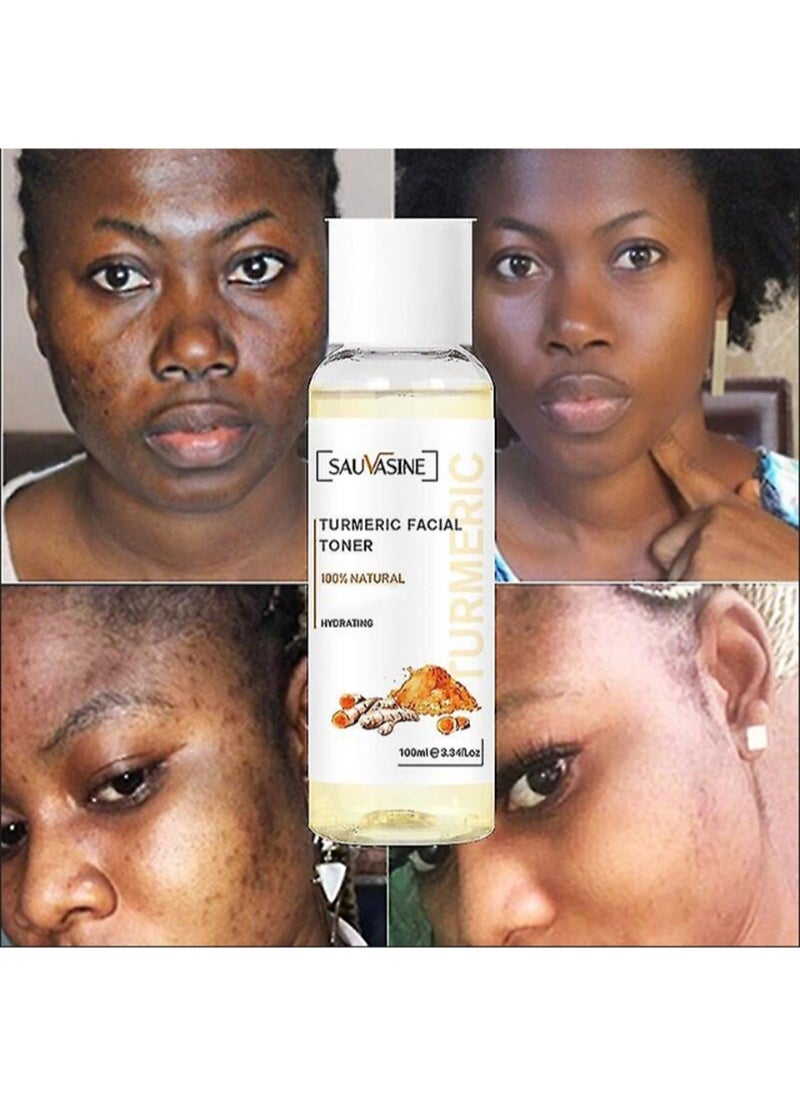 SAUVASINE - Turmeric Facial Toner for Dark Spots,Facial Toner for Acne Prone Skin, Facial Dark Spot Remover Facial Moisturizer for Women, Moisturizing Facial Toner for Dry Oily Skin - 100ml - Image 1