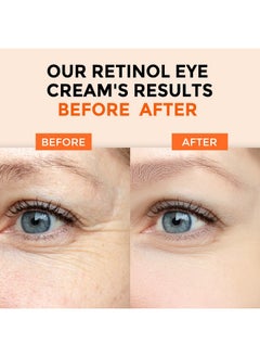 +1HEROLABS +1HEROLABS Retinol Eye Cream for Dark Circles and Puffiness, Anti Aging Under Eye Cream with Hyaluronic Acid, Retinol & Collagen to Fight Fine Lines, Wrinkles & Dark Spots  - Image 4