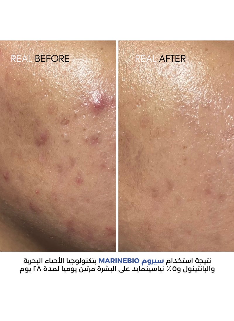 نات_بوتانيكالز سيروم مارين بايو 5% نياسيناميد مع  المستخلصات الحيوية البحرية و فيتامين ب5  - Image 3