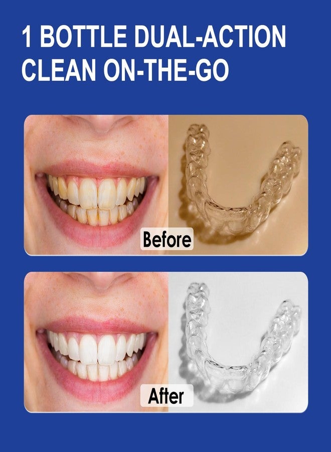 MySmile 2-in-1 Aligner/Retainer Cleaner & Teeth Whitening Foam, Great for Aligner, Retainer, Denture, Invisalign, Mouth Guard, Whitens Teeth, Kills Germs, Fights Bad Breath, Travel-Friendly - Image 4
