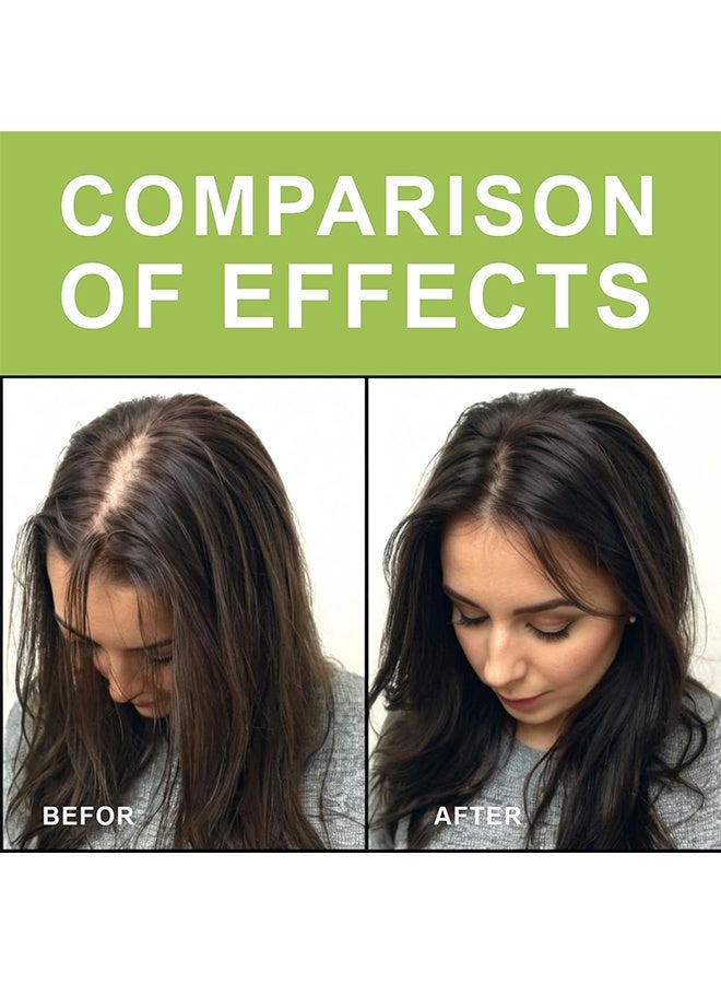 روزينو شامبو صلب برائحة إكليل الجبل الطازجة، صابون لنمو الشعر، صابون شامبو إكليل الجبل، يقوي جذور الشعر، يصلح الشعر التالف، ينظف فروة الرأس بعمق، يتحكم في الزيوت، يرطب ويغذي فروة الرأس - Image 5