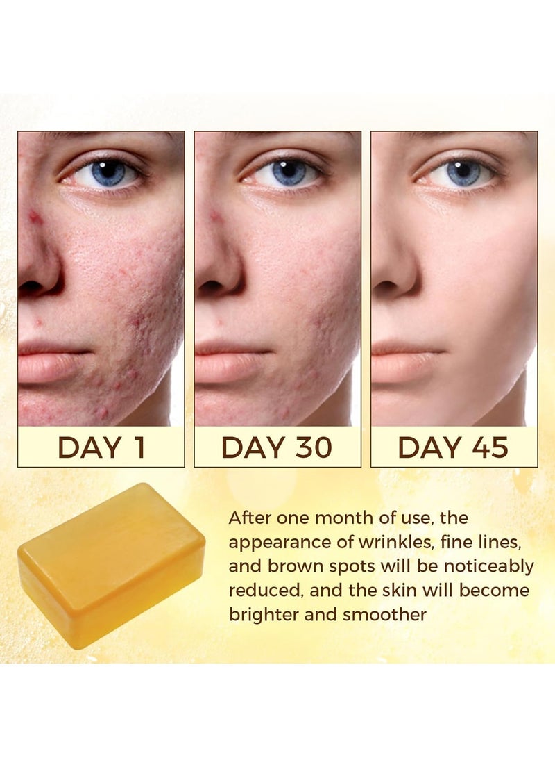 OUKEYA Turmeric Soap, Kojic Acid Dark Stain Remover Soap Turmeric Bar with Vitamin C, E, Retinol, Collagen and Shea Butter with Hyaluronic Acid, Soap for Men and Women - Image 2