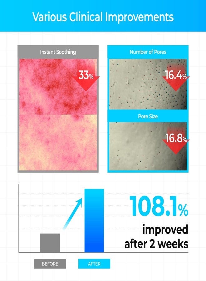 سيبوري كريم سيبوري شافيك المهدئ للبشرة الجليدية الأيسلندية | مرطب كوري للوجه للبشرة المعرضة لحب الشباب | ٥ أنواع من حمض الهيالورونيك | تهدئة فورية | عناية كورية بالبشرة | للبشرة الجافة والحساسة - Image 3