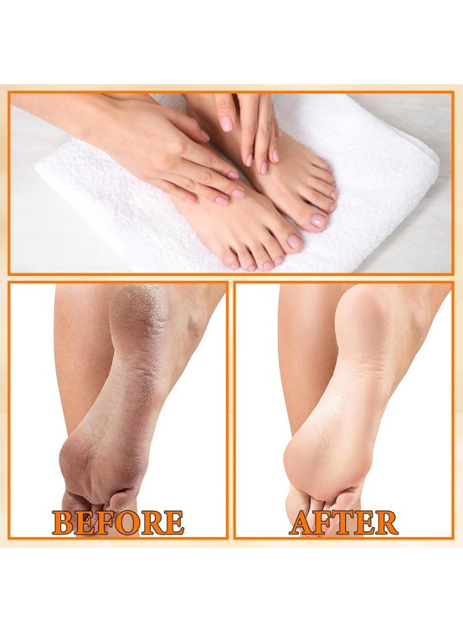 Foot Peel Spray for Dry & Cracked Feet Orange Oil Exfoliating Treatment, Dead Skin and Callus Remover for Rough Heels and Smooth Feet - Image 5